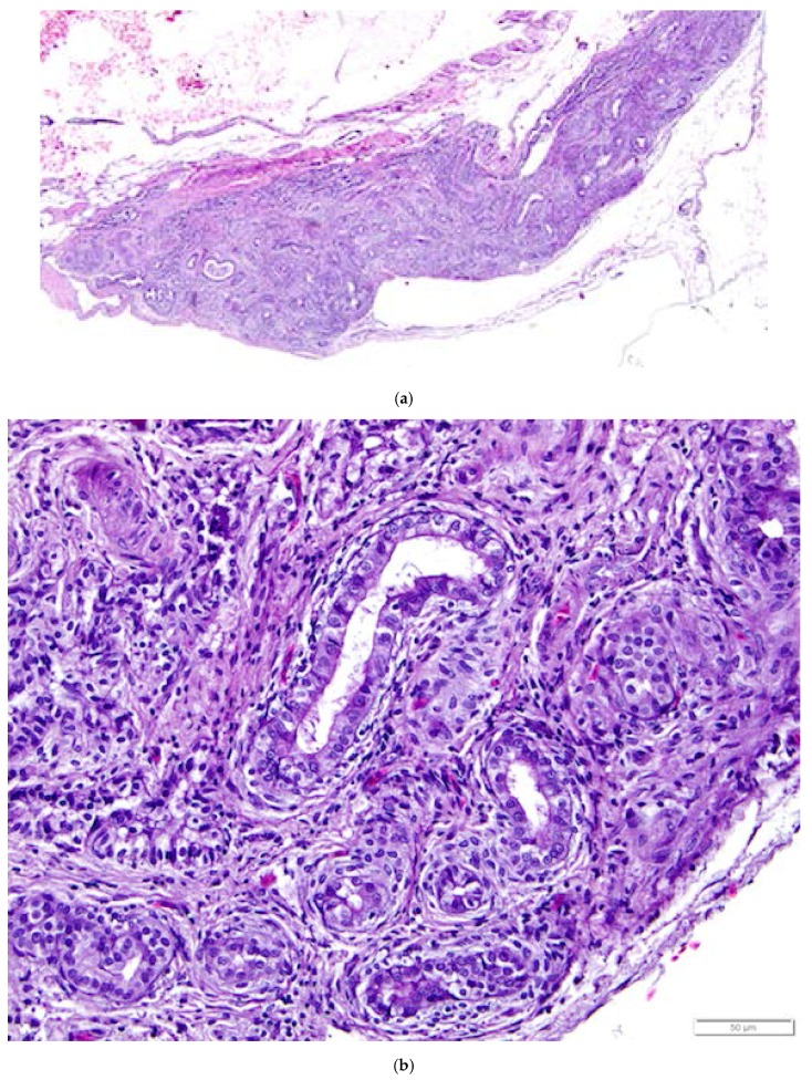 Figure 14