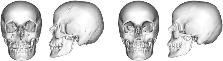 Fig 11