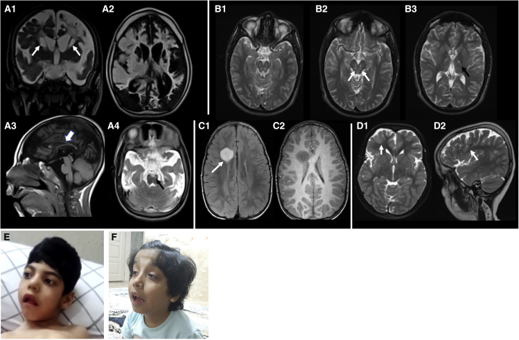 Figure 2