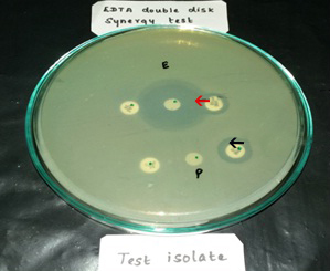 [Table/Fig-2]: