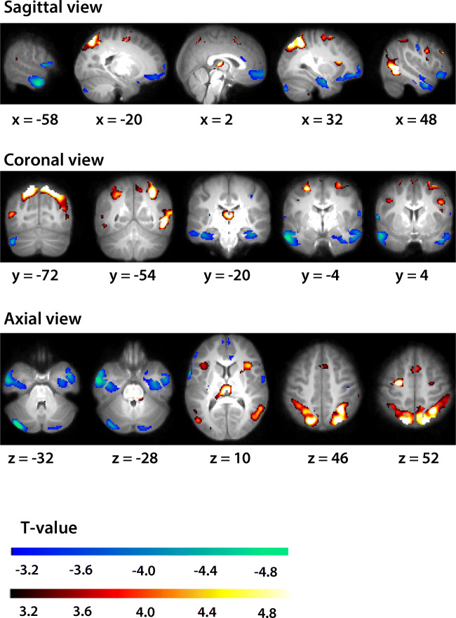 Fig. 2