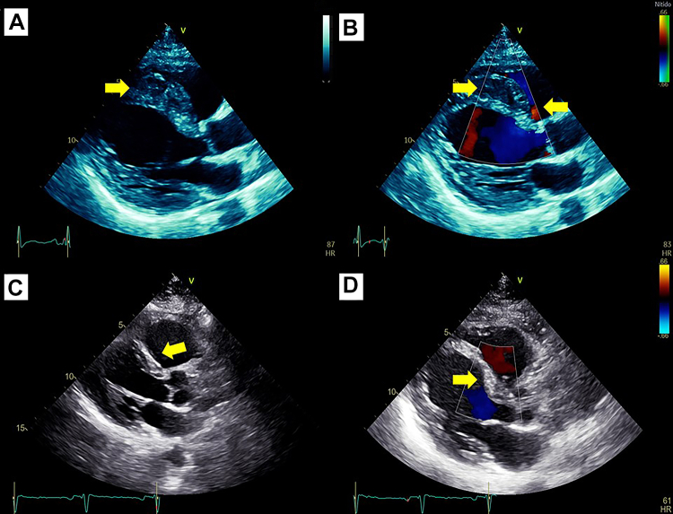 Figure 4