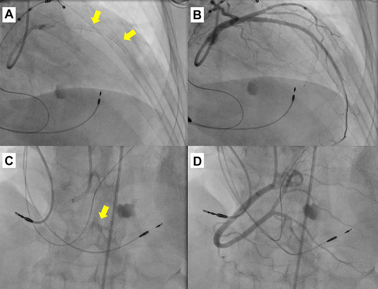 Figure 3