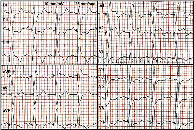 Figure 1