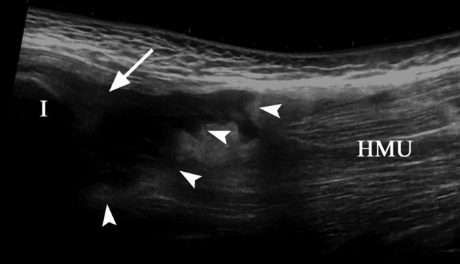 Figure 17