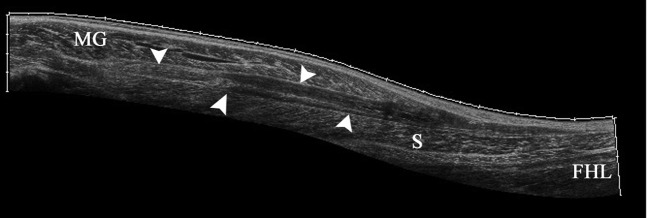 Figure 16