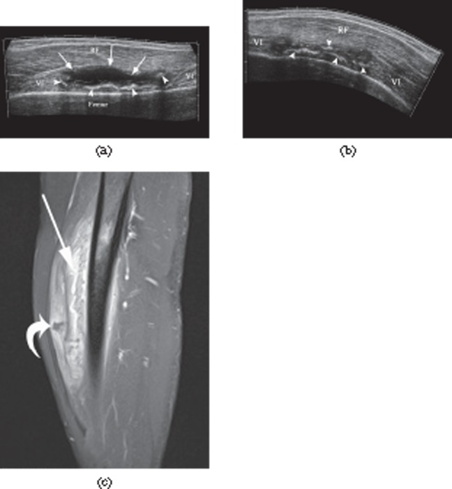 Figure 26