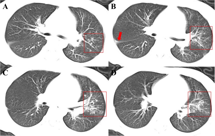 Fig. 3