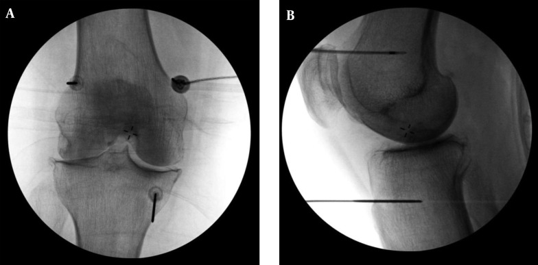 Figure 2.