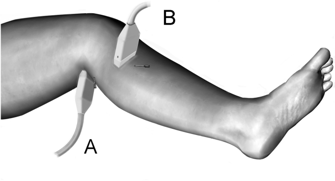 Figure 1