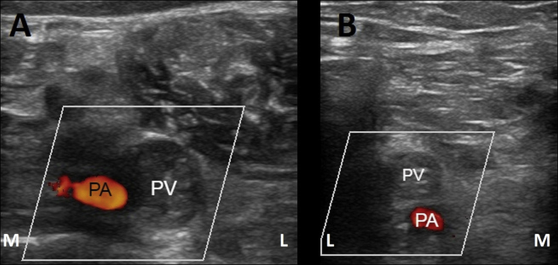 Figure 2