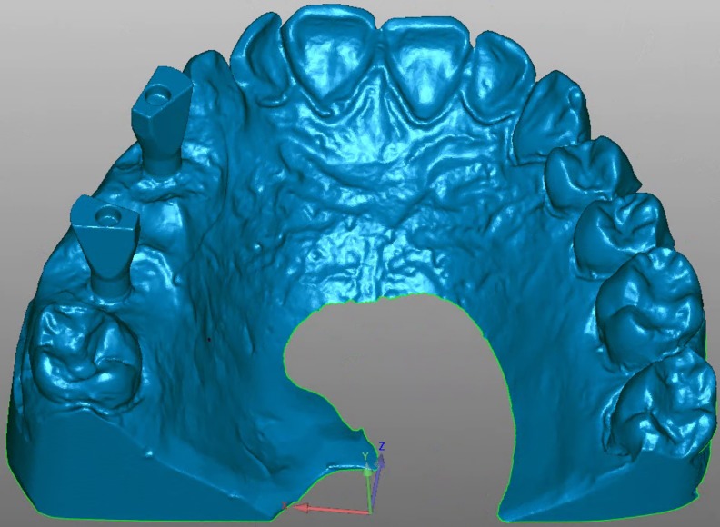 Fig 1