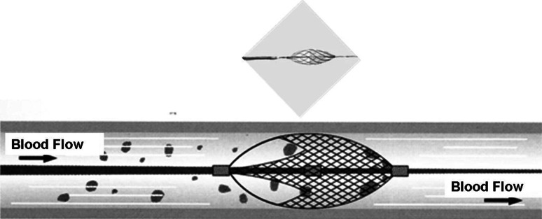 Fig. 1