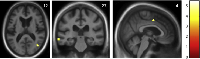 Fig. 1