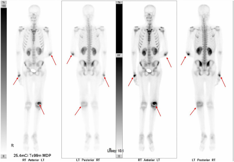 Figure 11.