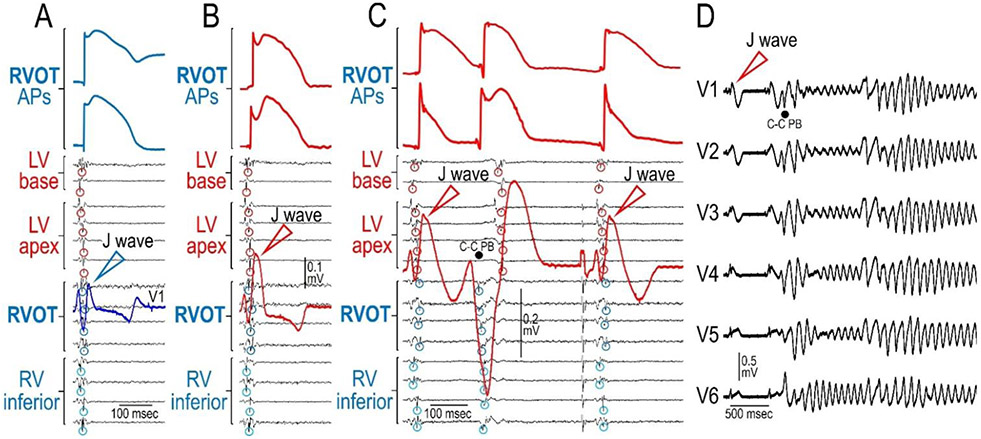 Figure 11.