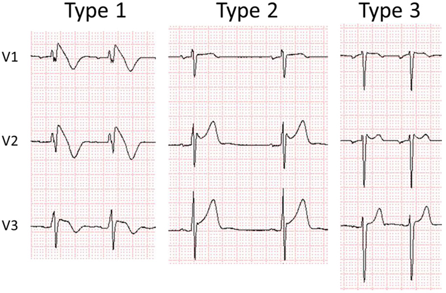 Figure 1: