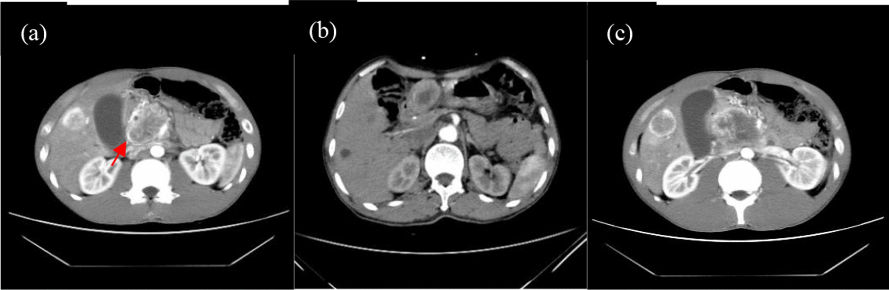 Fig. 2