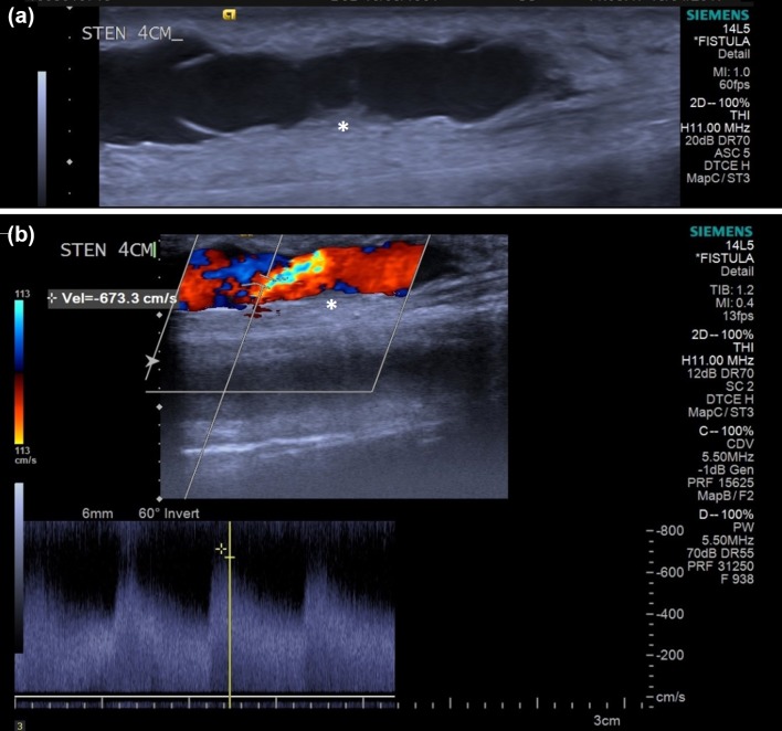 Figure 1