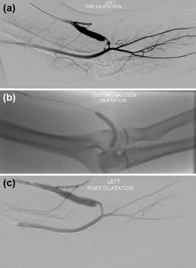 Figure 3