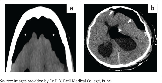 FIGURE 14