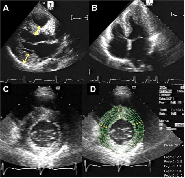 Figure 2