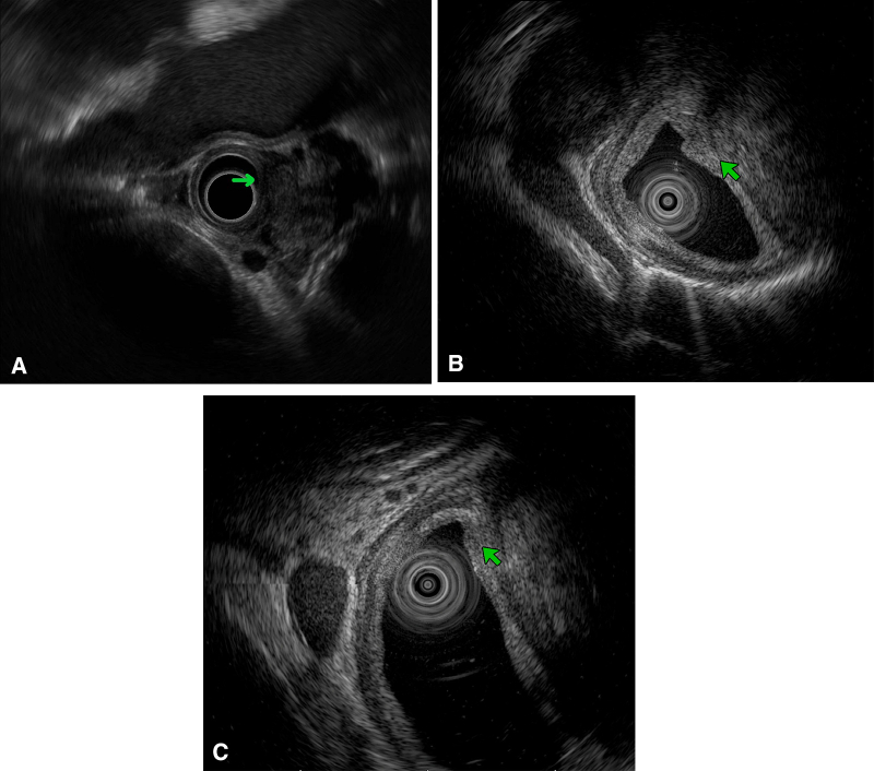 Figure 2