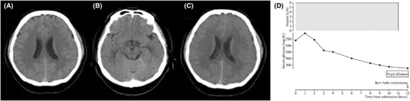 FIGURE 1