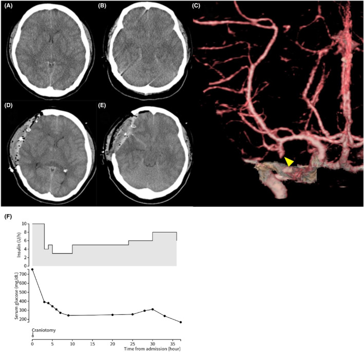 FIGURE 2