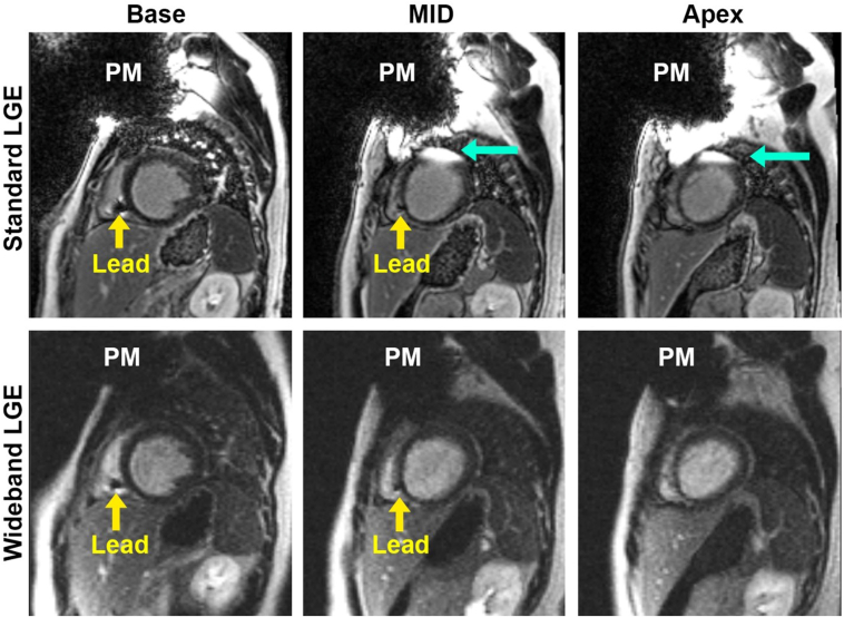 Figure 3