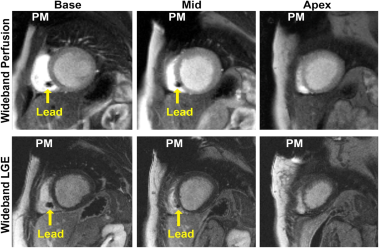 Figure 2