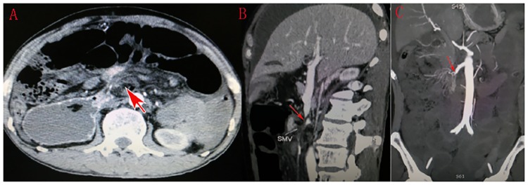 Fig 2