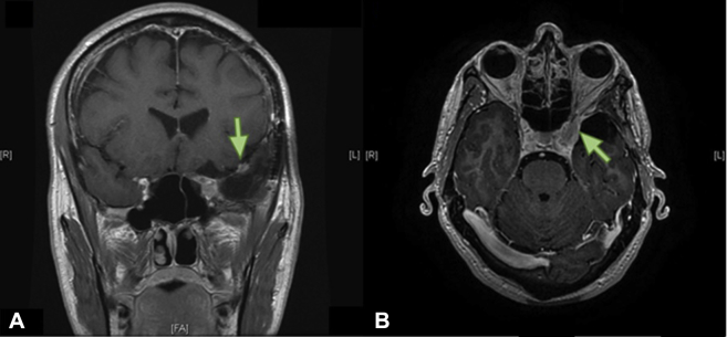 Figure 2