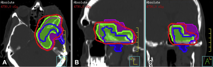 Figure 4