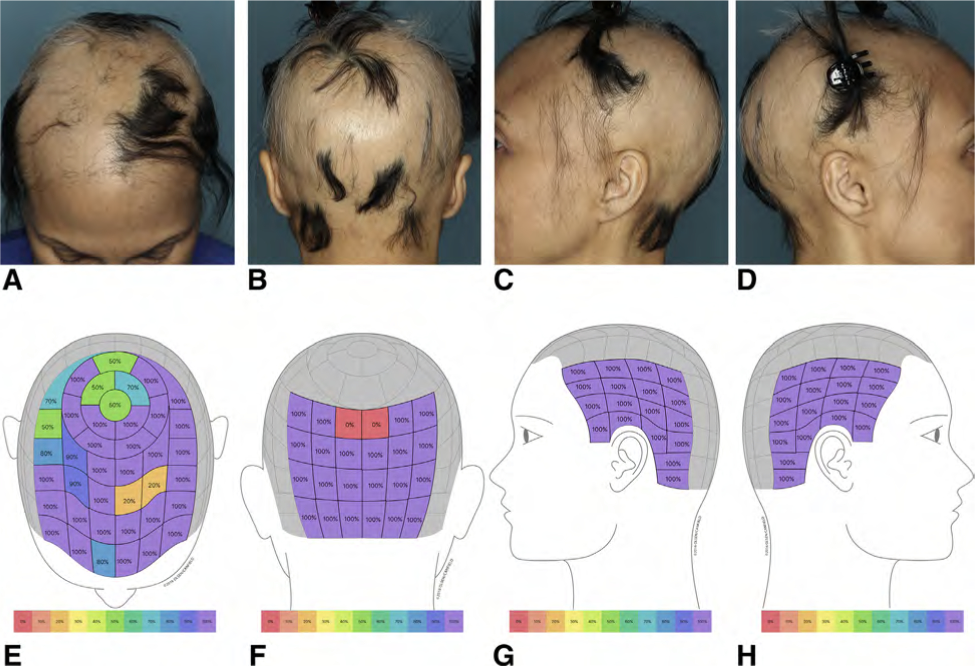 Fig 3.