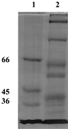 FIG. 1