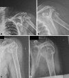 Fig. 1A–D