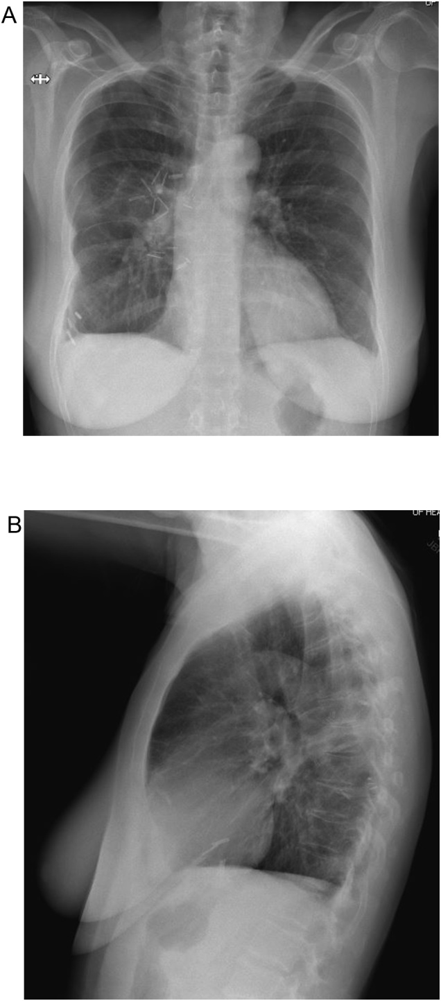 Fig. 5