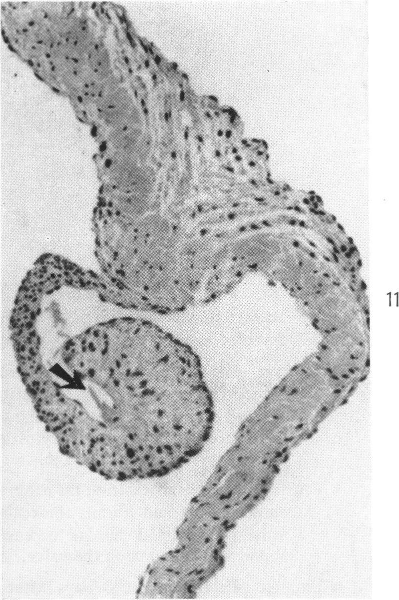 Fig. 11