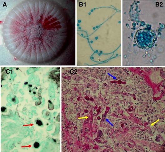 FIG. 1.