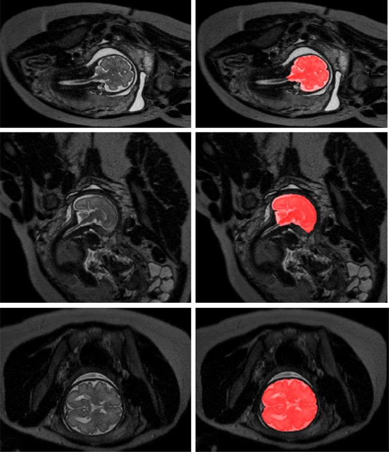 Fig. 11