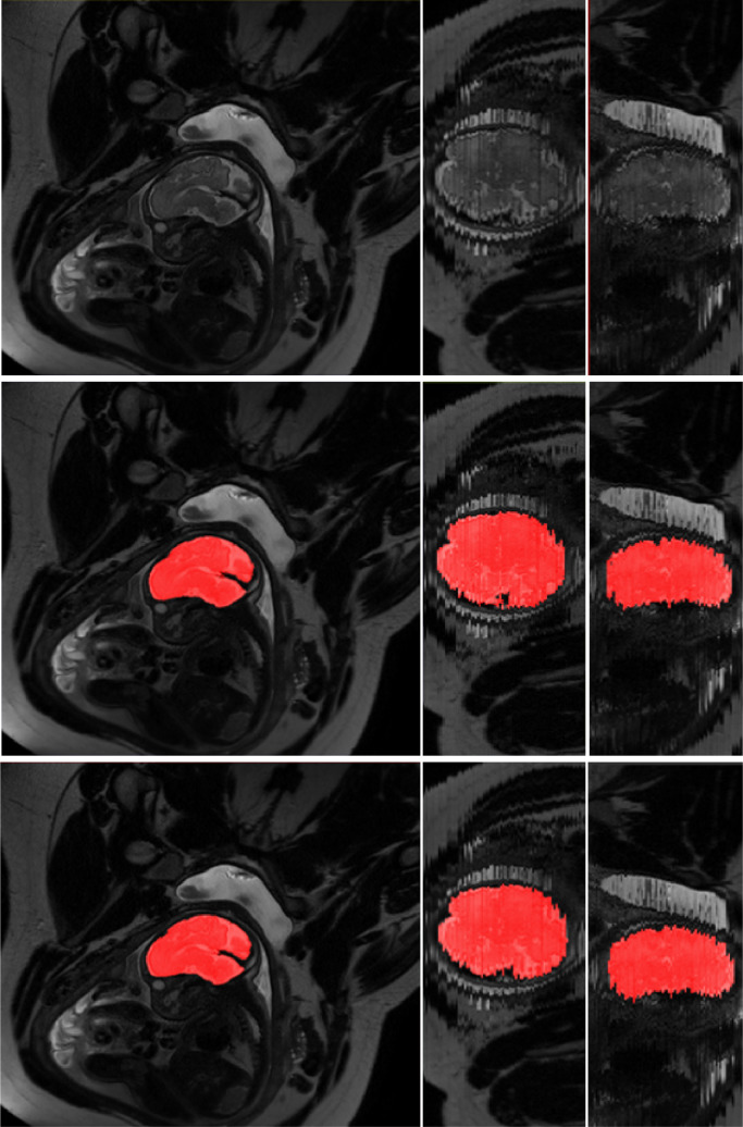 Fig. 5