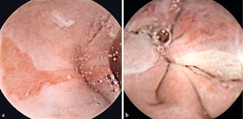 Fig. 1 a