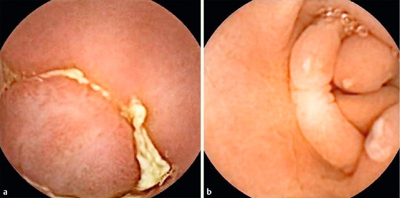 Fig. 2 a