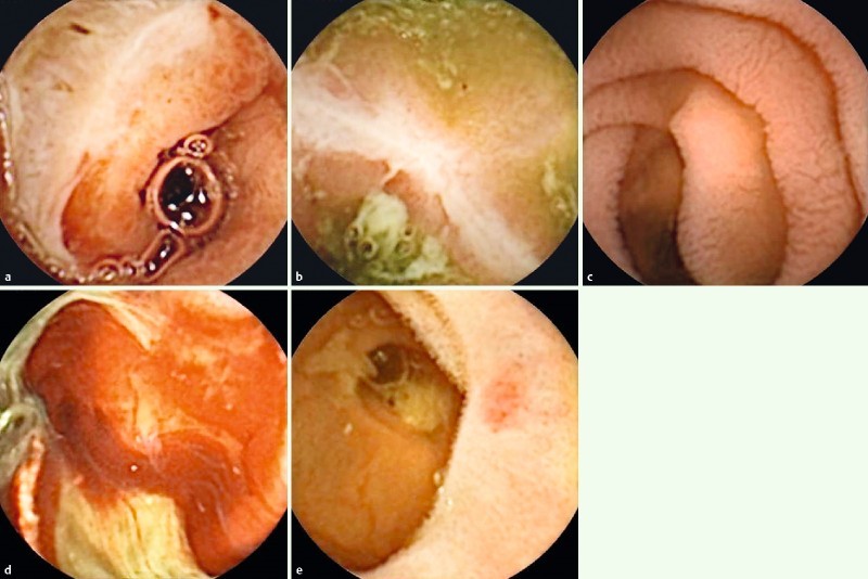 Fig. 3 a