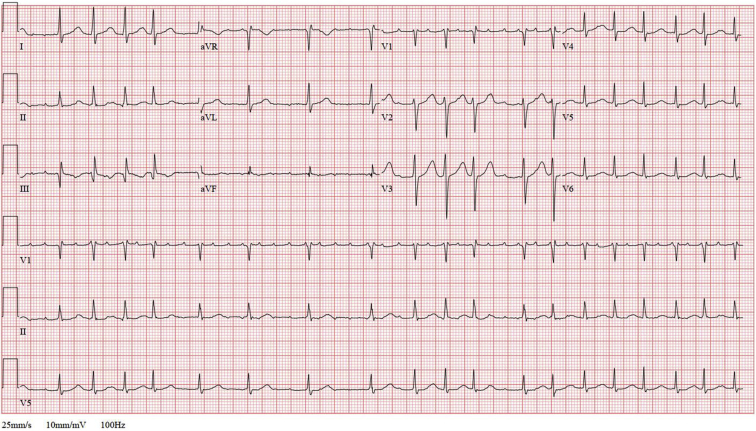 Figure 3