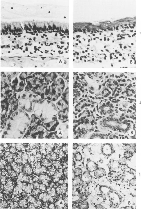 Figure 1-3