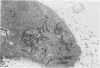 1925