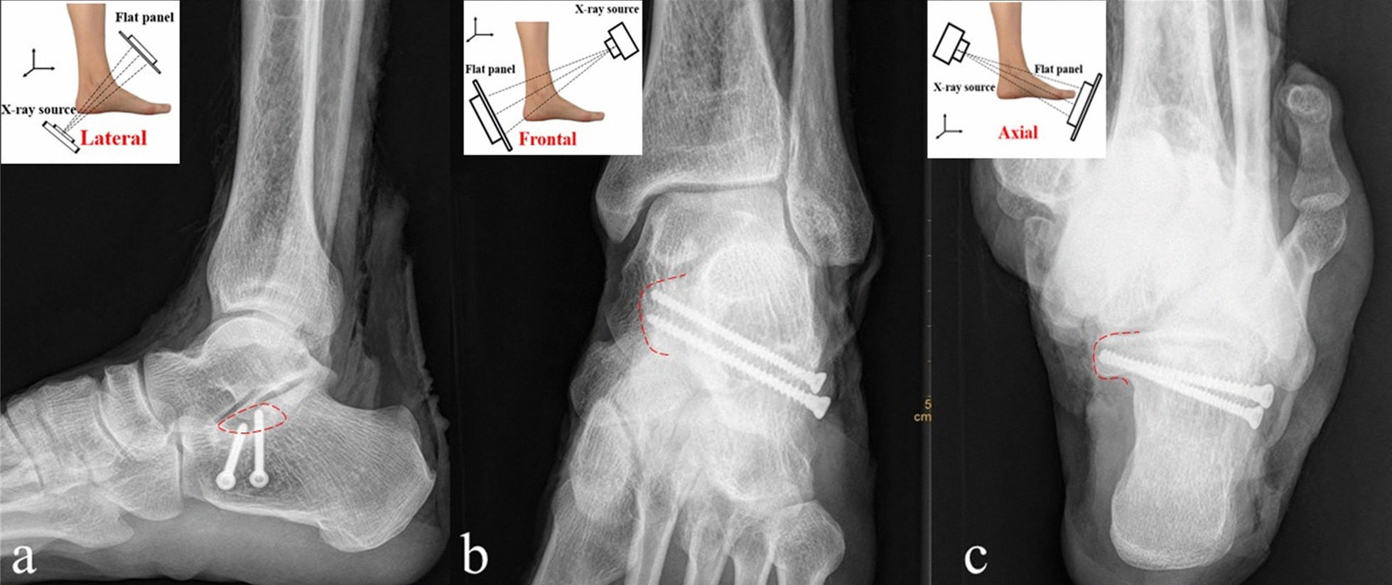 Fig. 6