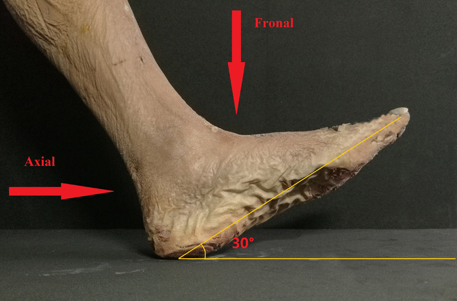 Fig. 2